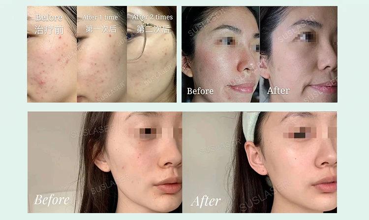 Нам нужны дистрибьюторы, био-свет, антивозрастной светодиодный свет, терапевтическая машина