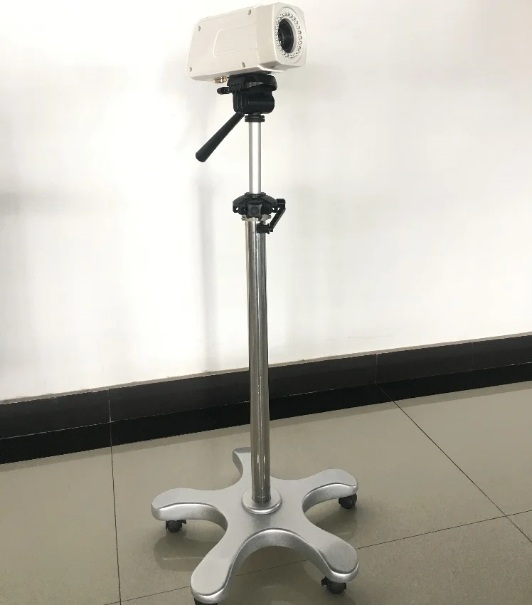 SANWE  SW-3303 Digital Colposcope   Electronic Colposcope  Colposcopy