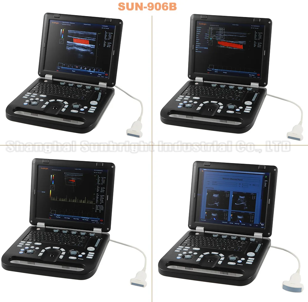 Portable Color Doppler Ultrasound Machine Price Medical Echocardiography with Phased Array Probe