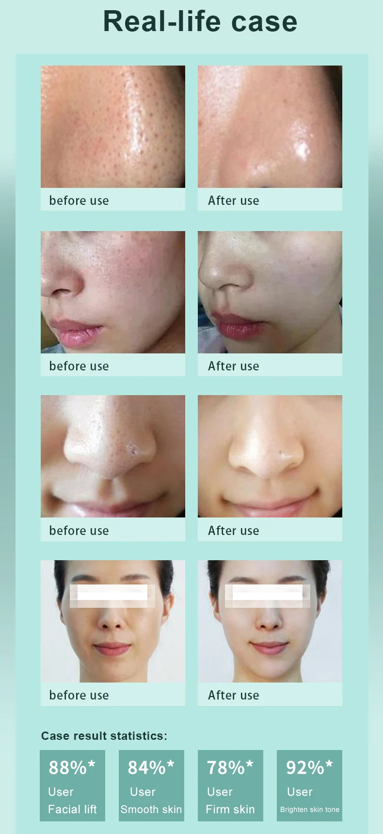 8 In 1 Portable Facial Hydro Dermabrasion Microdermabrasion Water Hydra Oxygen Jet Peel Machine