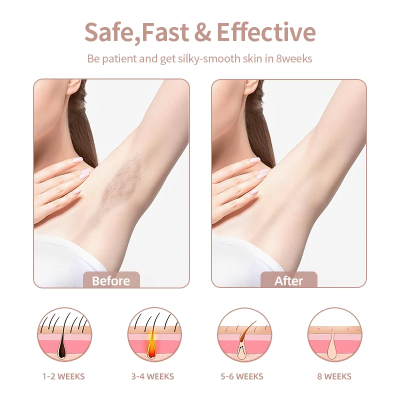 At Home Multifunction 999999 Flashes  Painless Permanent Ice Cooling Depilator Portable IPL Hair Removal Remover