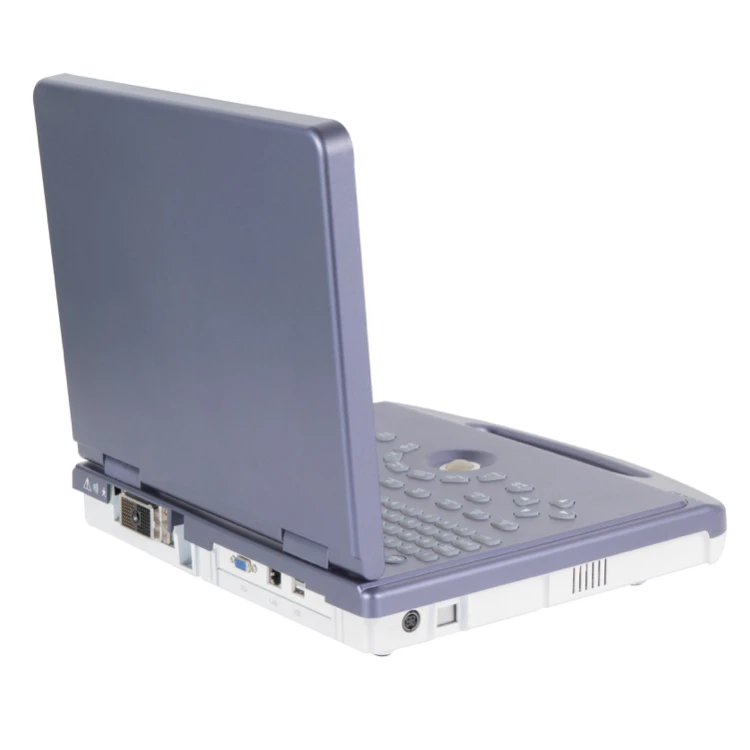 Digital Ultrasound Scanner Cheap Linear Ultrasound Scanner Bondway Ultrasound Scanner Fetal