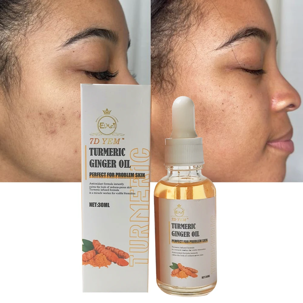 High quality natural turmeric ginger oil 30ml anti aging brightening anti acne organic vitamin C facial skincare serum oil