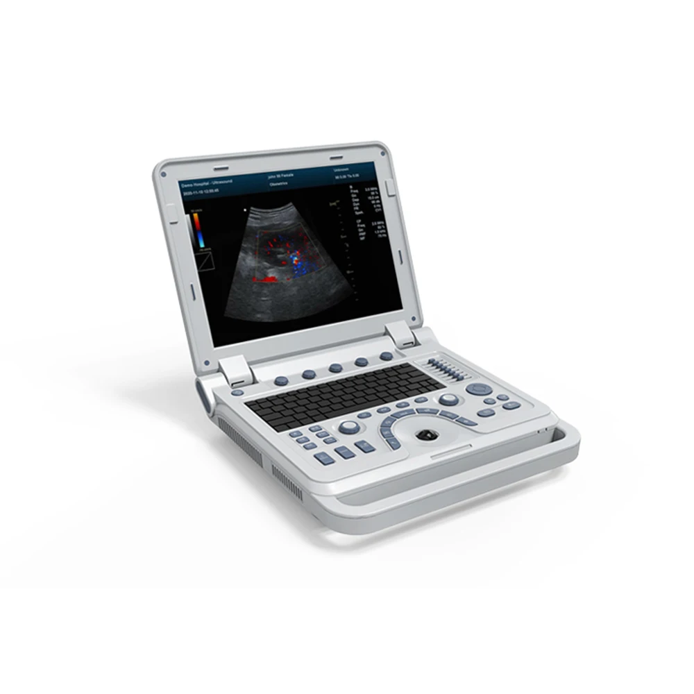 Contec CMS600P2PLUS portable ultrasound machine pseudo Color Doppler Ultrasonic Diagnostic System