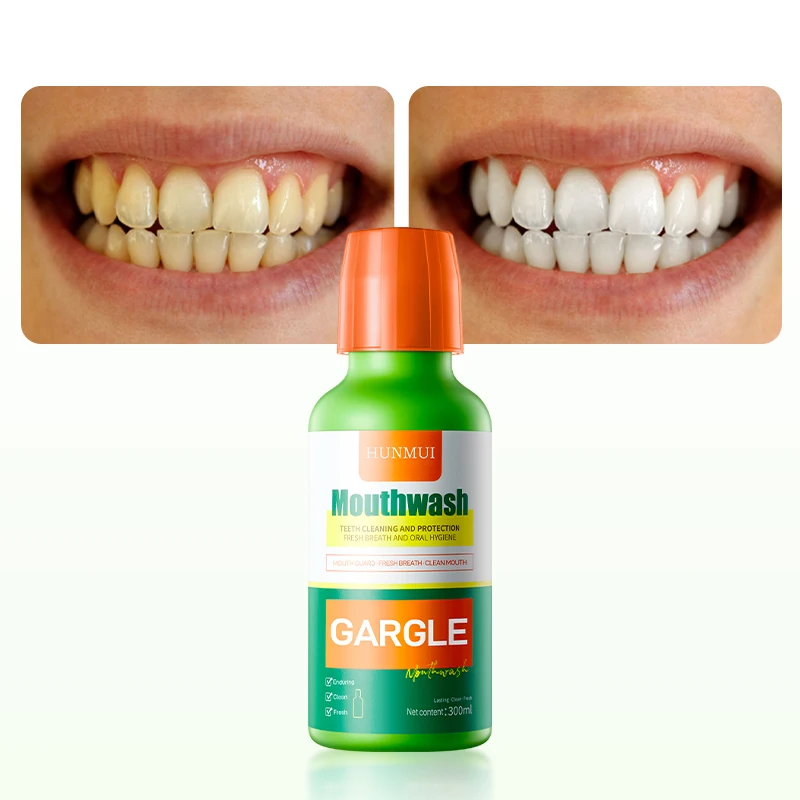 Daily Oral Health Oral Cleaning Antibacterial Breath Fresh Whitening  Liquid Mouthwash