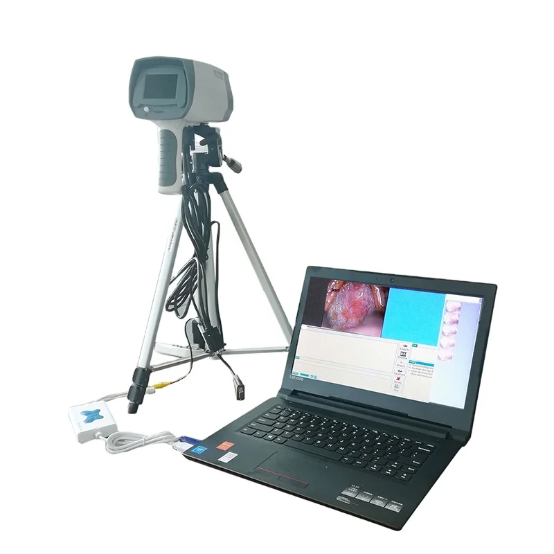 China factory Vaginoscope price Vaginoscope software for Medical equipment OEM service