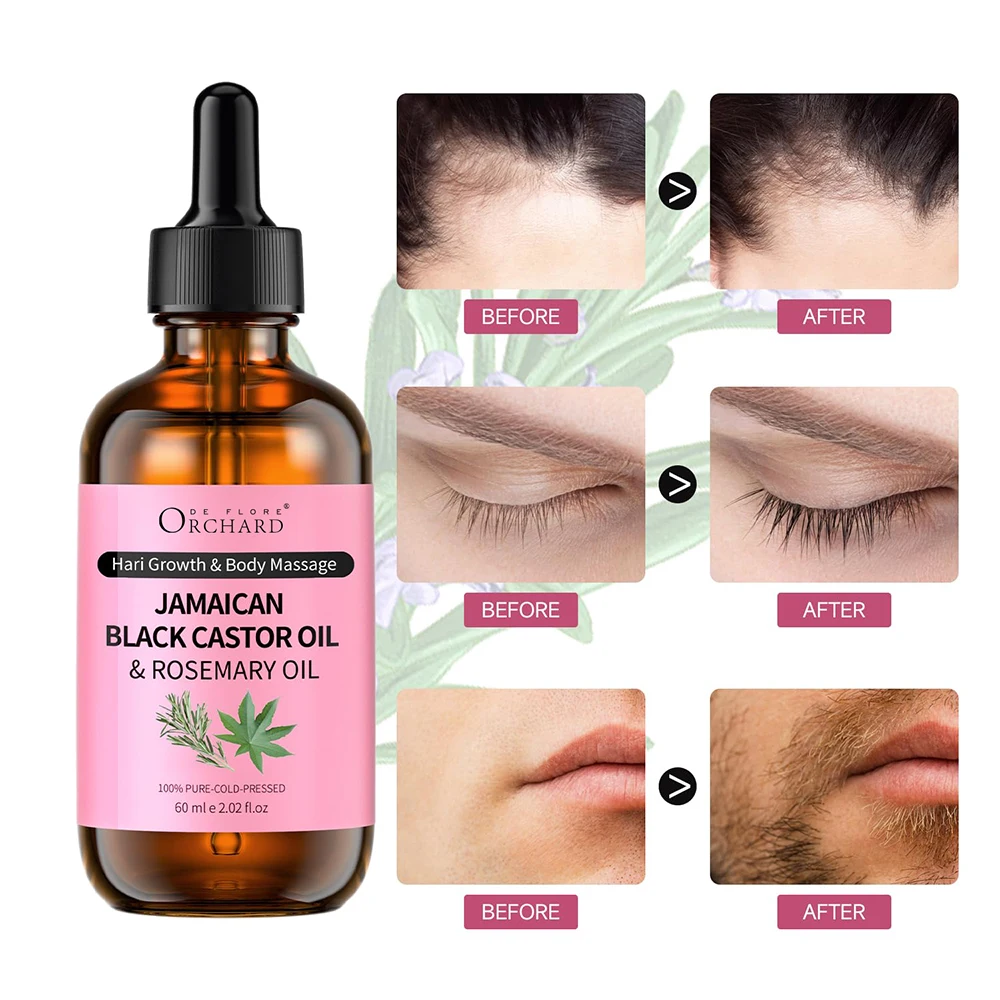 Hot Sale Jamaican Black Castor Oil with Rosemary,Black Castor Oil Cold Pressed,Organic Castor Oil for Hair Growth and Eyelashes