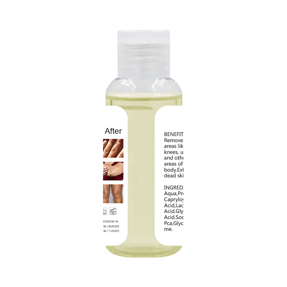 Effective Knuckles Whitening for Remove Dead Skin Orange Peeling Oil for legs