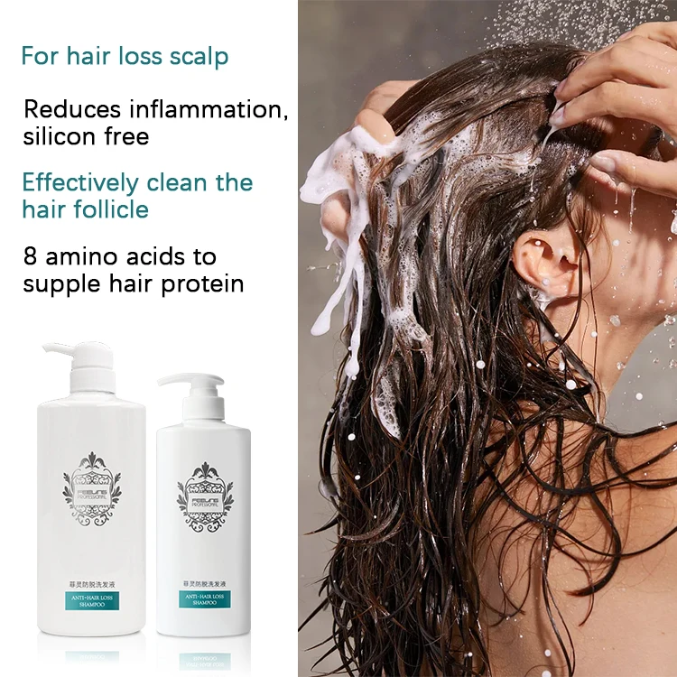 OEM Pro Hair-Anti Hairloss Shampoo 1000ml TCM Ingredients Silicone-Free Chinese Government Certificate
