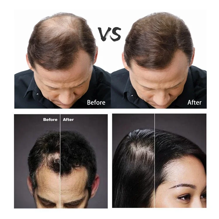 Пудра для наращивания волос от производителя BUNEE, 27,5 г, фирменные волоконные волокна