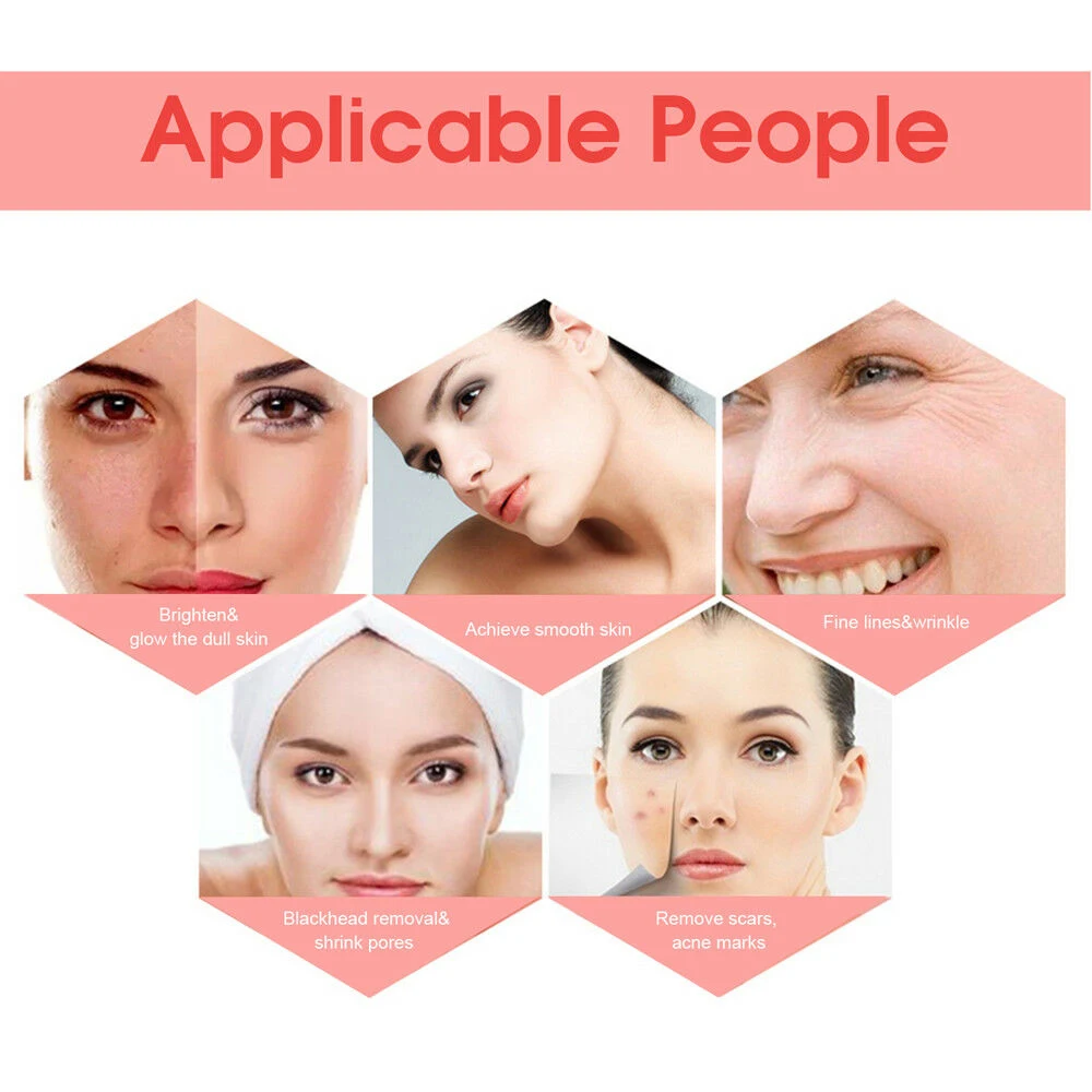 Private label 100% Pure Cold Pressed Unrefined Reduce Acne Scars Rosehip Seed Oil Pure Essential Oil