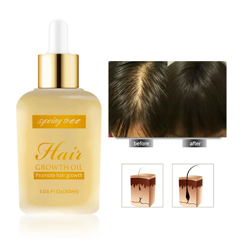 Hair Loss Treatment Anti Balding Hair Growth Serum Vegan Organic Nourishing Scalp Hair Care Oil