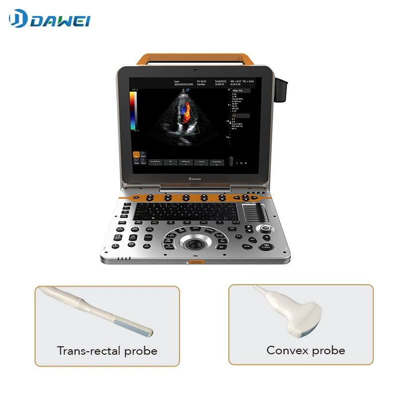 DAWEI P60 4D Portable Color Doppler Human Ultrasound Gynecology Cardiovascular Echo Machine Sale scanner with CE&ISO certificate