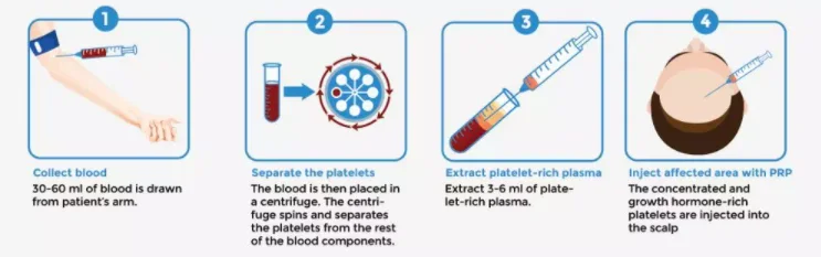 paste-pic-dp_uuid_oq5bv