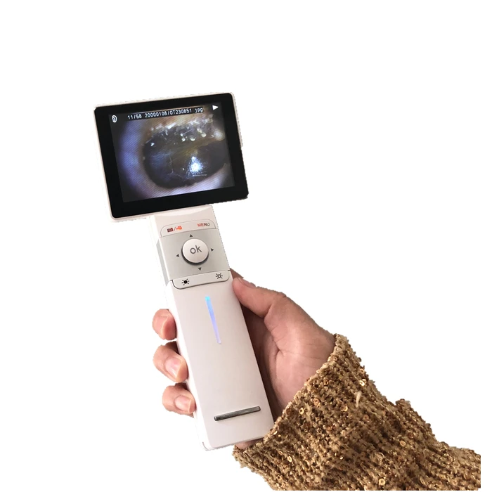 Ophthalmic Equipment Digital Otoscope Ophthalmoscope Dermatoscope Veterinary Video Otoscope