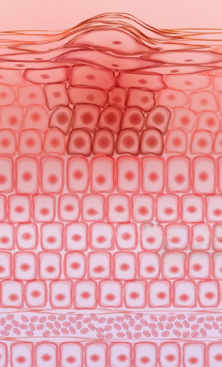 IBOOLO DE-4100 Advace Professional optical dermatoscope , best effect dermalight hud dermoscopy Dermoscopy in the world