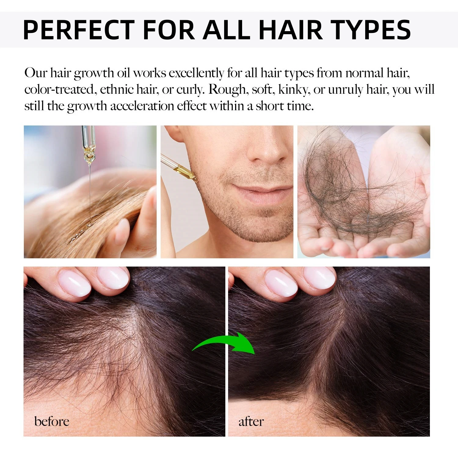 Wholesale Private Label 100% Natural Rosemary & Biotin Nourishing Scalp Oil Hair Care Loss Treatment Serum Hair Growth Oil