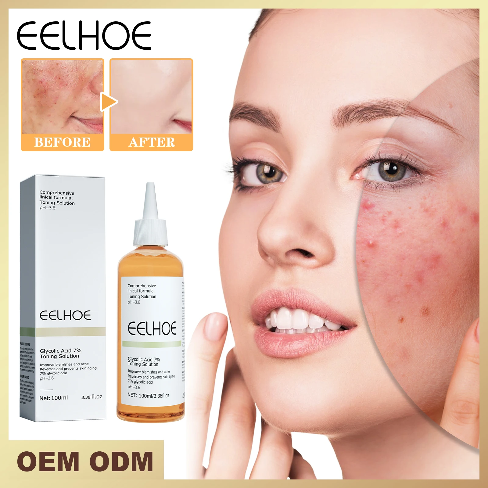 EELHOE Glycolic Acid 7% Toning Solution Gentle Exfoliation Shrink Pores Acne Removing Brighten Facial Essence Toner Adults 135g