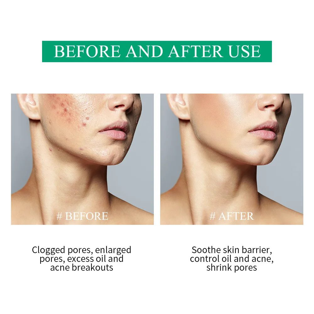 BREYLEE jelly cup clay mask skin whitening clay face mask face deep pore cleansing mud clay facial mask