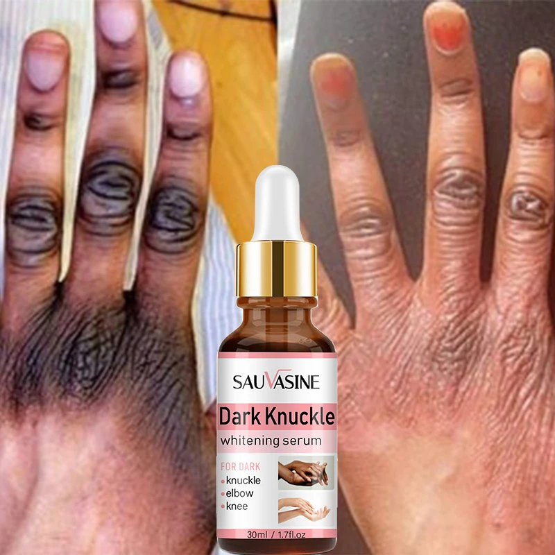 Private Label Black Skin Honey Peeling Lightening Whitening Exfoliating Hand And Body Lotion Dark Knuckles Removal Hand Mask