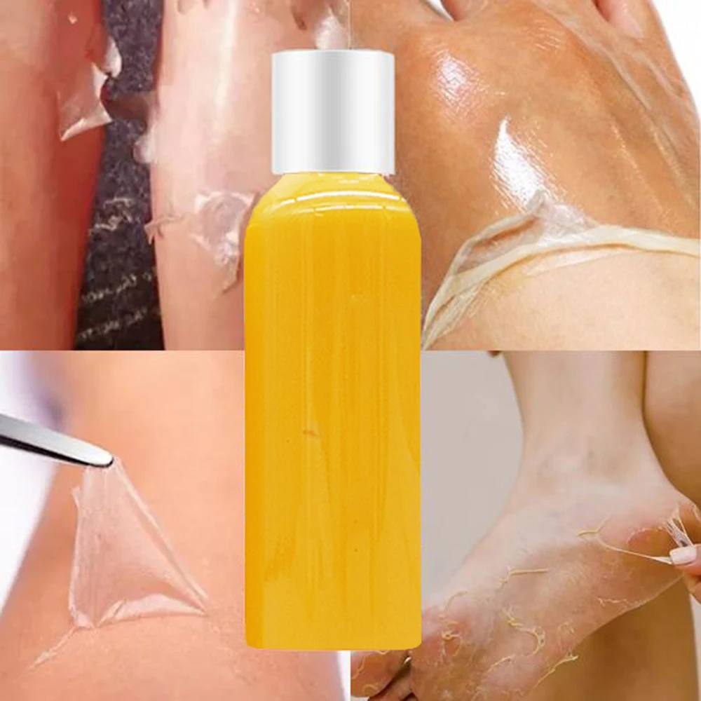 Hot-selling Peeling Lotion Wholesale Moisturizing Whitening Scars Lightening Dark Spots Dark Knuckle Body Care Orange Lotion