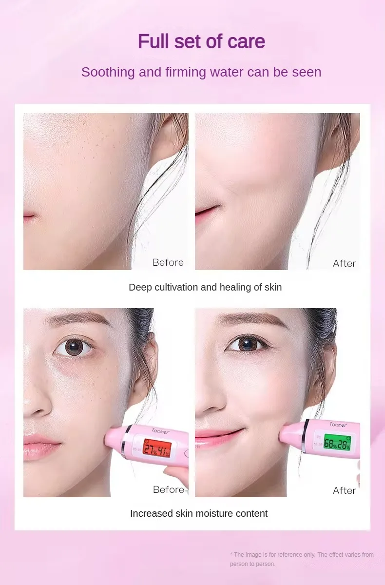 AINUO Soothing Skin Toner Elastic Moisturizing Water for Softening and Softening Skin