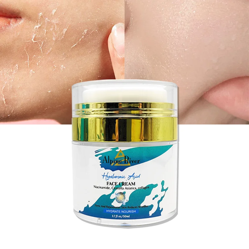 Private Label Natural Organic Vitamin E Skin Care Products Skin Whitening Moisturizing Nourishing Skin Care Creams & Lotions