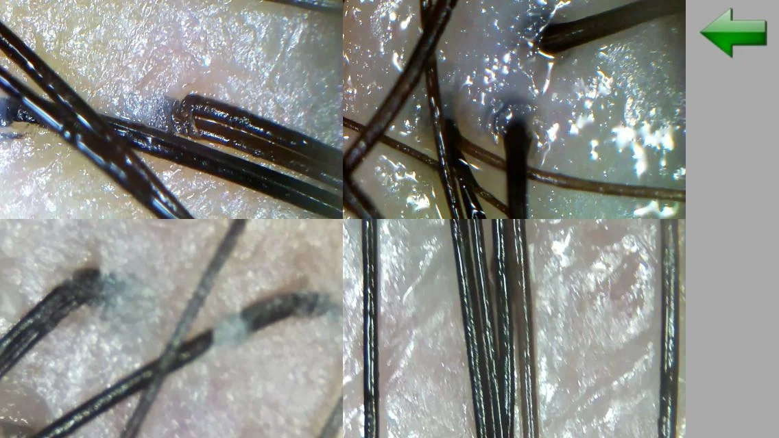 Portable HD Hair Follicles Scalp Scanner Detector Hair Analyzer  Skin And Scalp Hair Analysis Machine