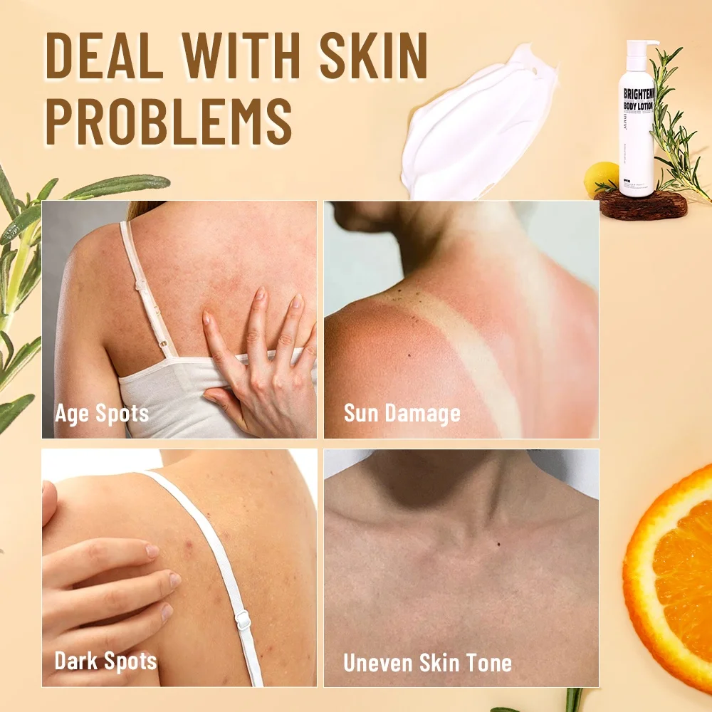 Private Label Arbutin Vitamin C Skin Brightening Lighten Dark Spots Niacinamide Kojic Acid Whitening Body Lotion