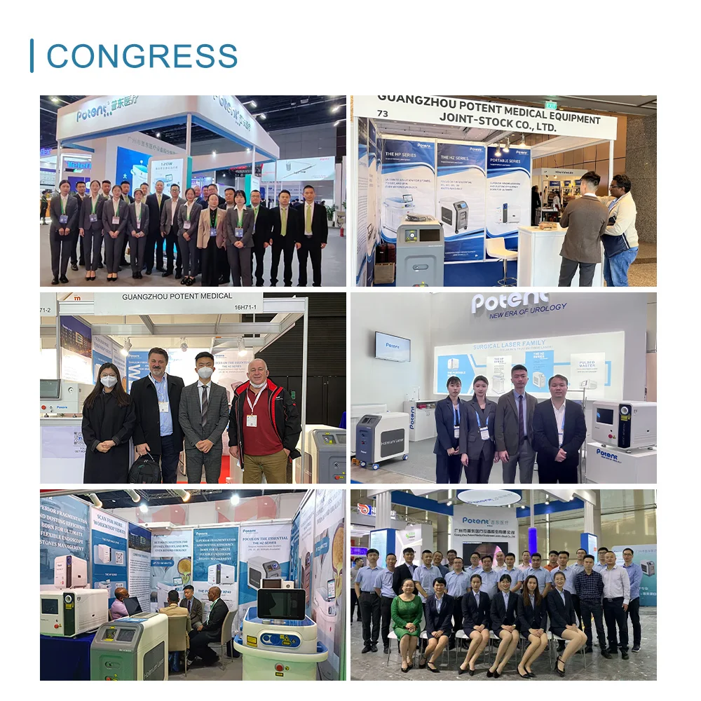 Potent Urology equipment lithotripter 40W 90W 80W holmium medical laser for ureter urethra stricture resection Ablation