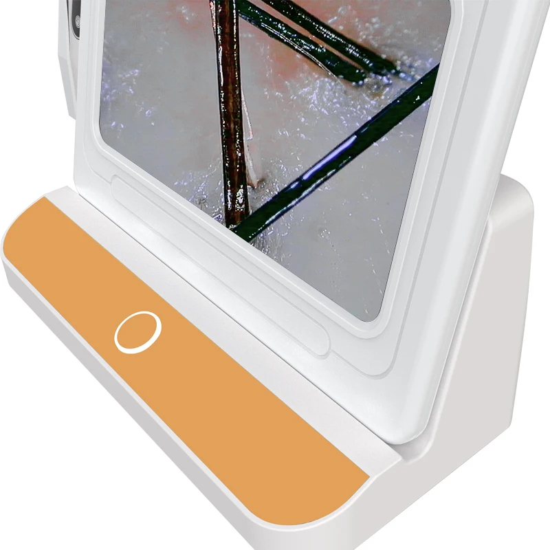 Hair salon dedicated HD hair skin detector all-in-one scalp scanner