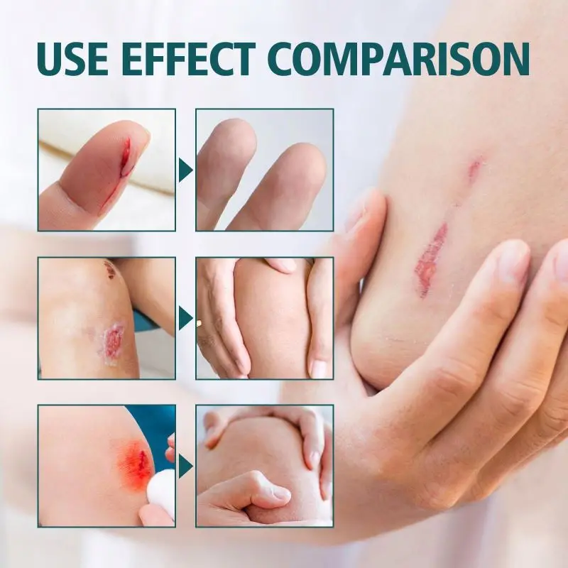Wholesale Custom Logo Wound Repair Scar Smoothing Skin Renewal Triple Antibiotic Ointment