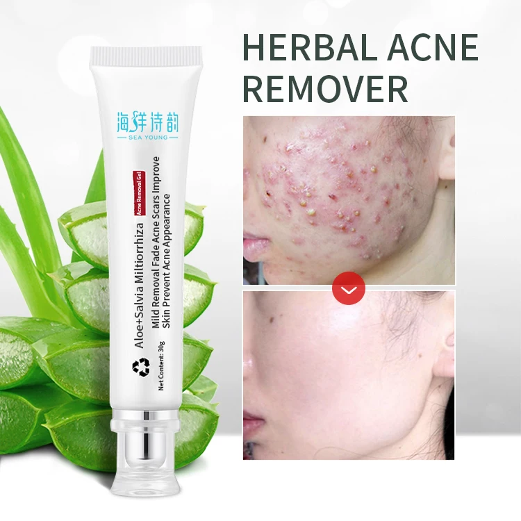 OEM/ODM Limpiador 30g Acne Removal Herbal Extract Skin Care Aloe Vera Acne Removal Gel for Acne Mark Skin