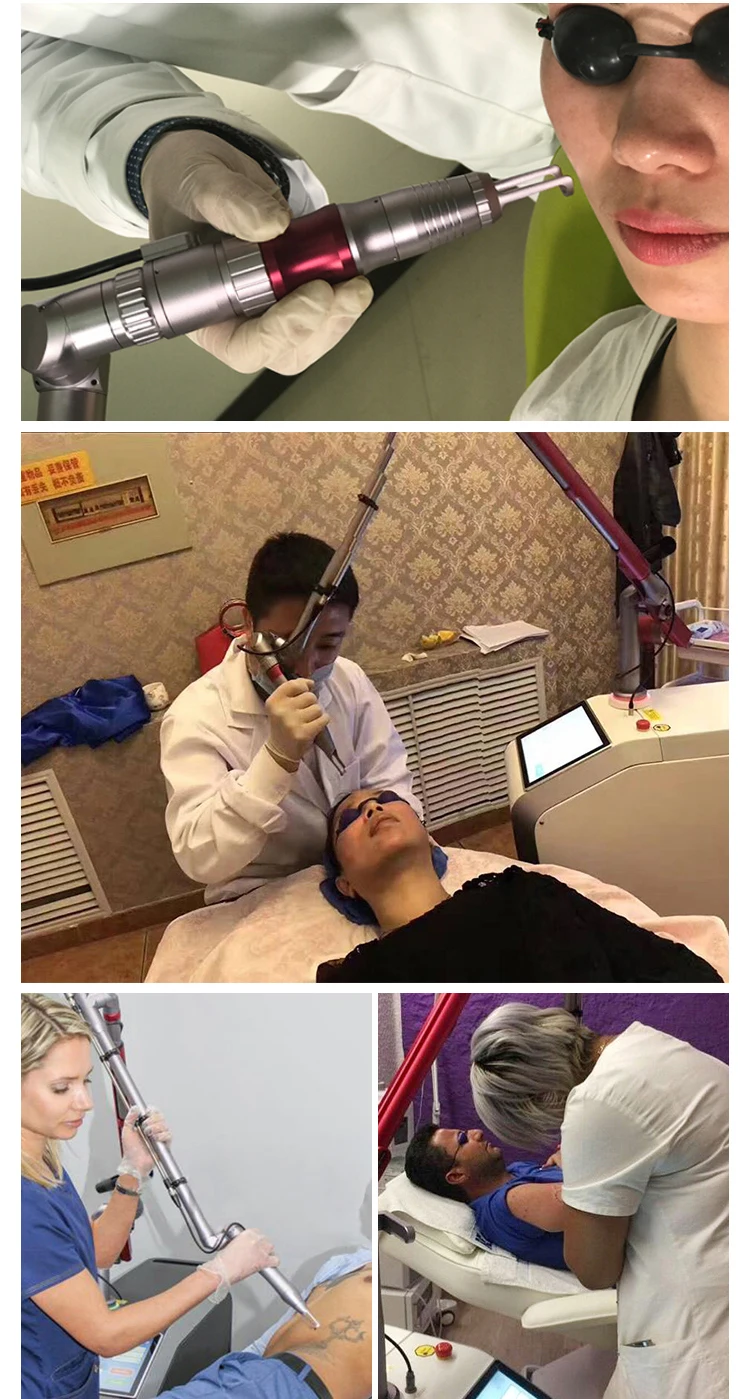 Q switch nd yag laser tattoo removal beauty machine 1064nm 532nm laser picosecond medical CE TGA approval