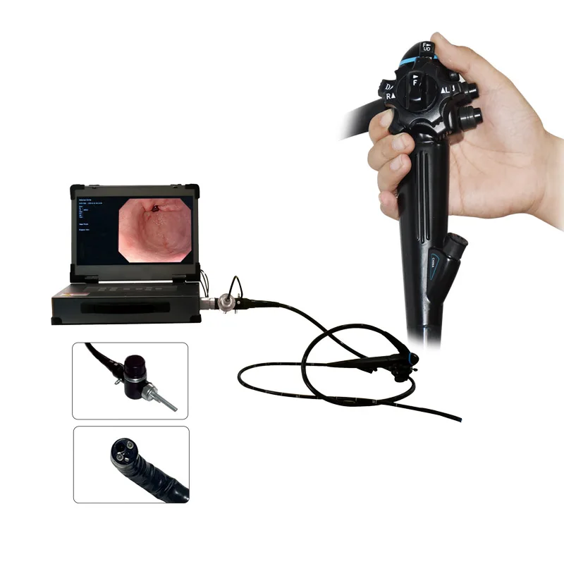 Manufacturer Medical Endoscope System  Flexible Gastroscope and Colonoscope