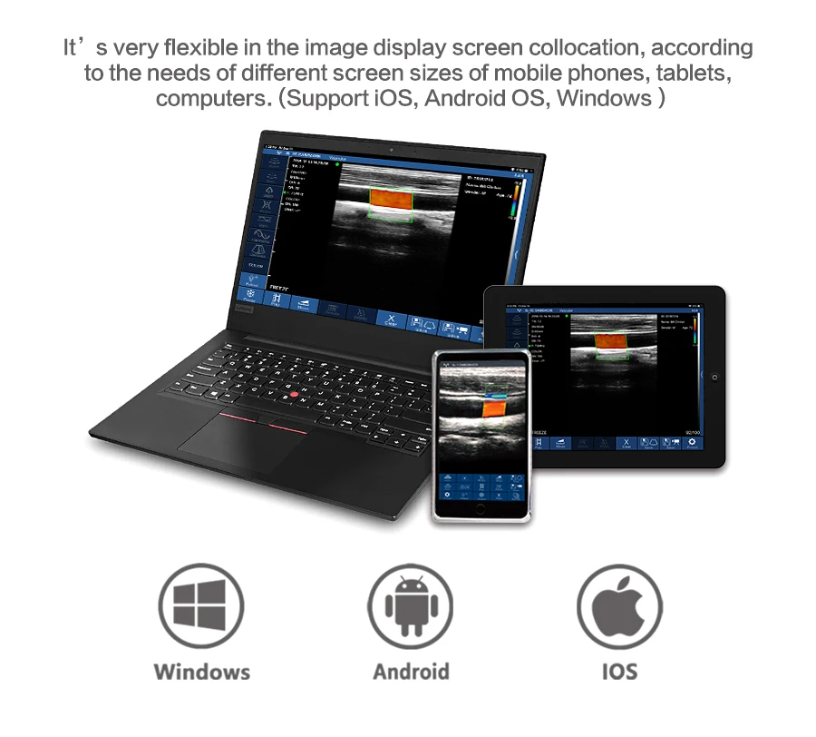 Соностар ультразвук 2 в 1 с двумя головками Цветной Допплер выпуклый & линейный аппарат УЗИ сканер