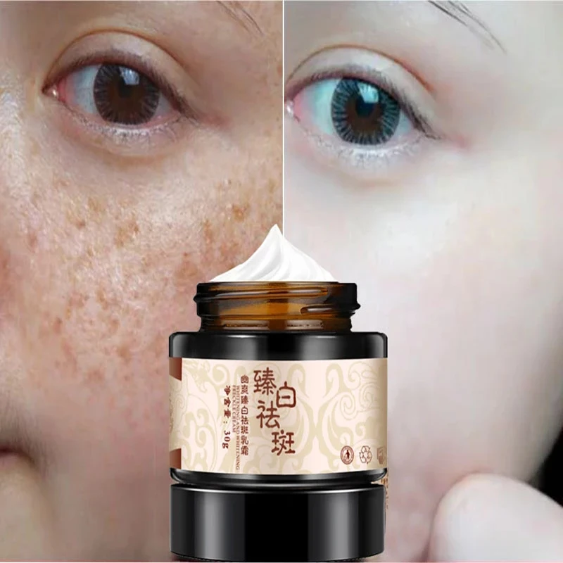 Oem Collagen Cream Skin Improving Whitening And Freckle Removing Cream