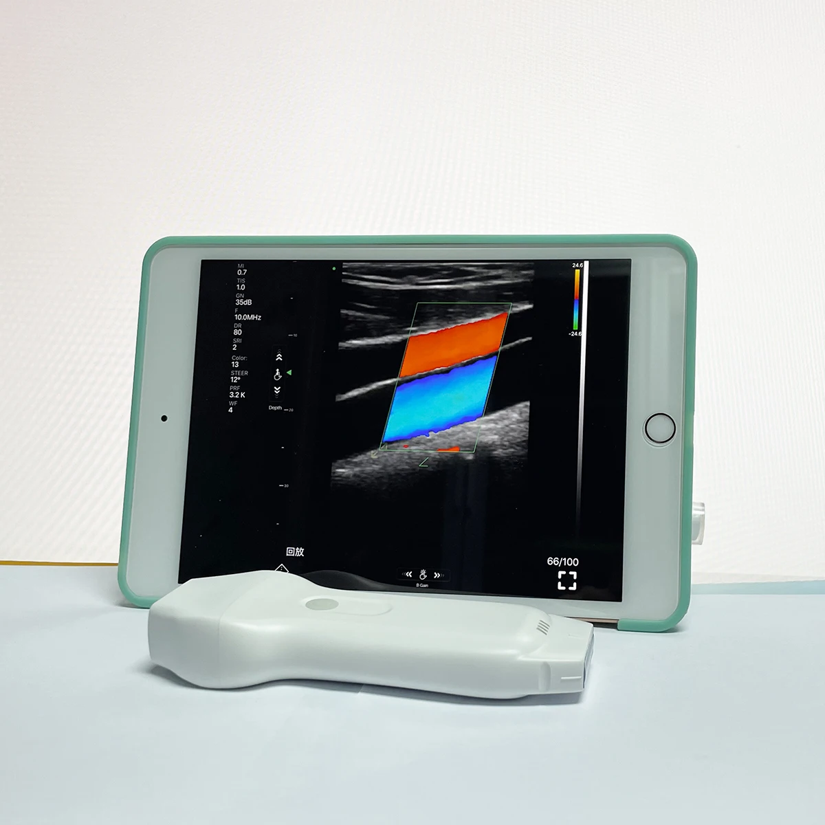 CE Double Probes Wireless Color Doppler Ultrasound Scanner