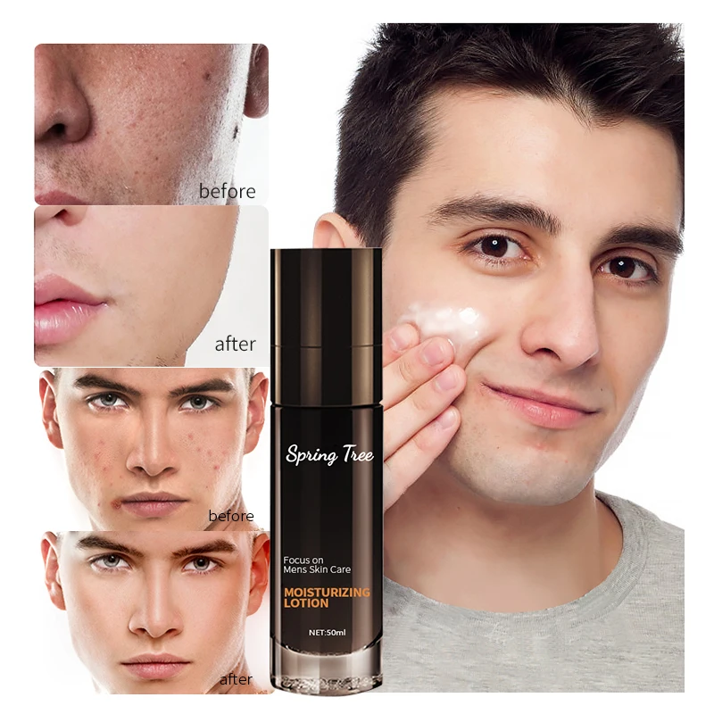 Men Moisturizer Best Repair Brightening Moisturizing Skin Whitening Face Body Lotion