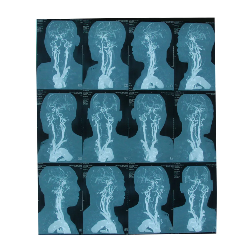 The biggest sales event of CT MR MRI DR film