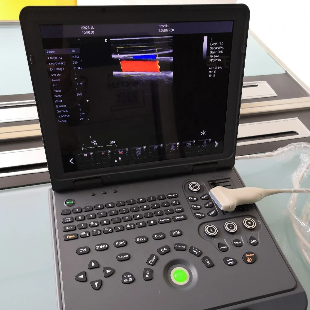 Портативный цветной доплеровский ультразвуковой аппарат высокой четкости/Медицинские ультразвуковые инструменты