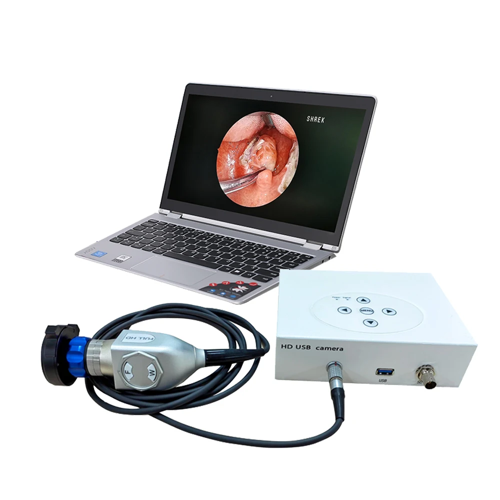 medical hd usb endoscope camera usb video laryngoscopy system