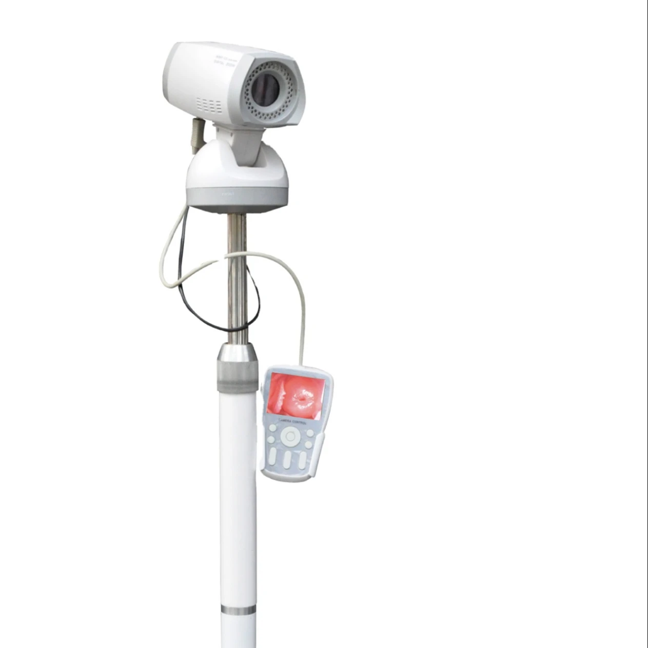 China Supplier Colposcope Gynecology Examination Optical Colposcopio for Clinic