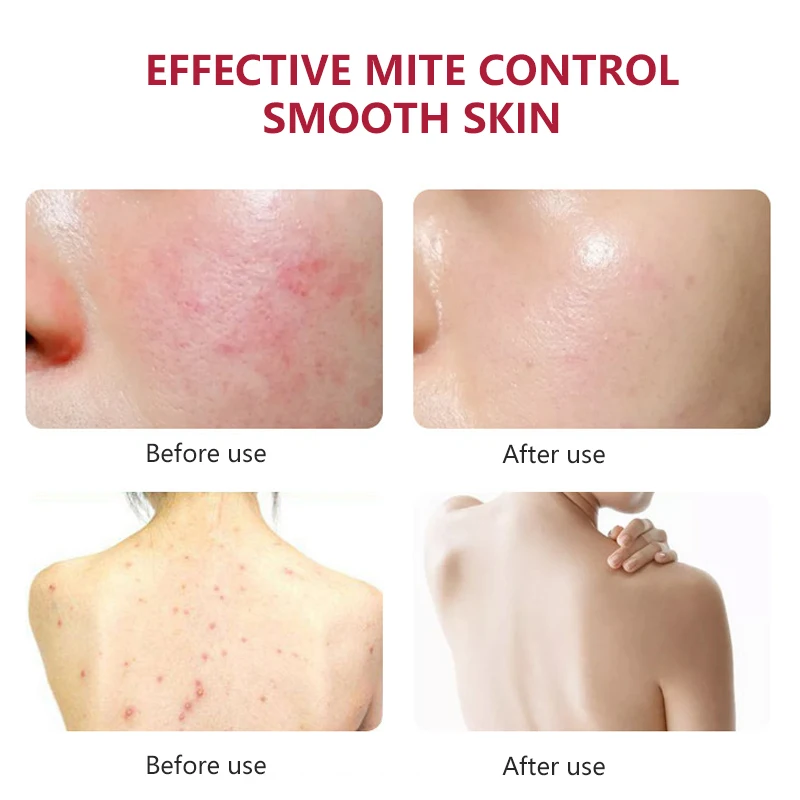 Lemon Essential Oil Glycerin Soap, Natural Handmade Beauty Soap-338190