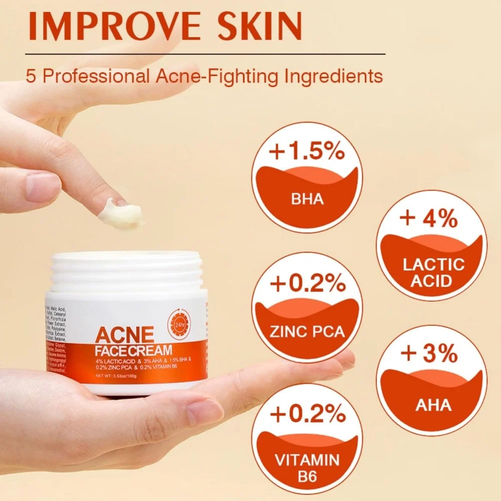Private Label Acne Face Cream Anti Acne Refreshing Skin Oil Control Hydrating Fade Scars Reduce Acne Redness Face Cream