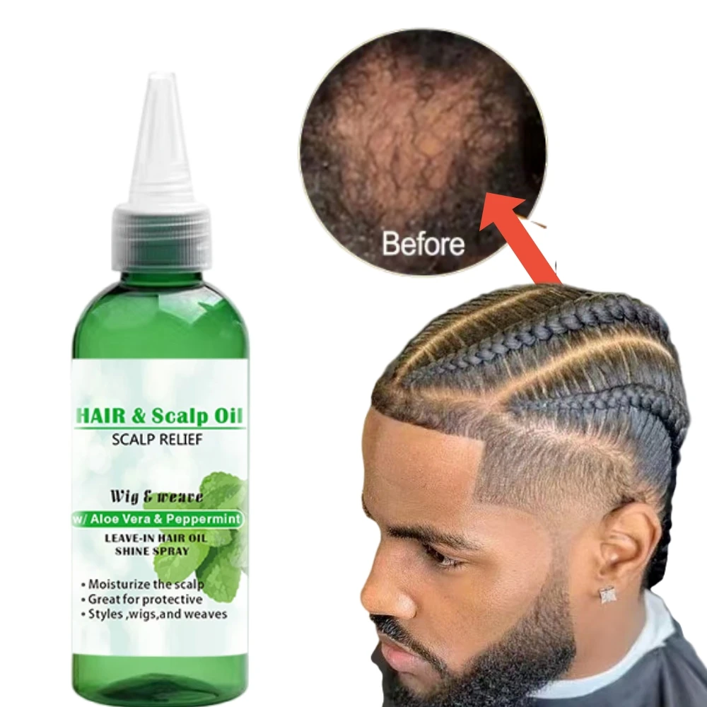 Private Label Natural Organic Biotin Keratin Anti Loss Regrowth Hair Treatment Scalp Care Products Hair Growth Oil Serum