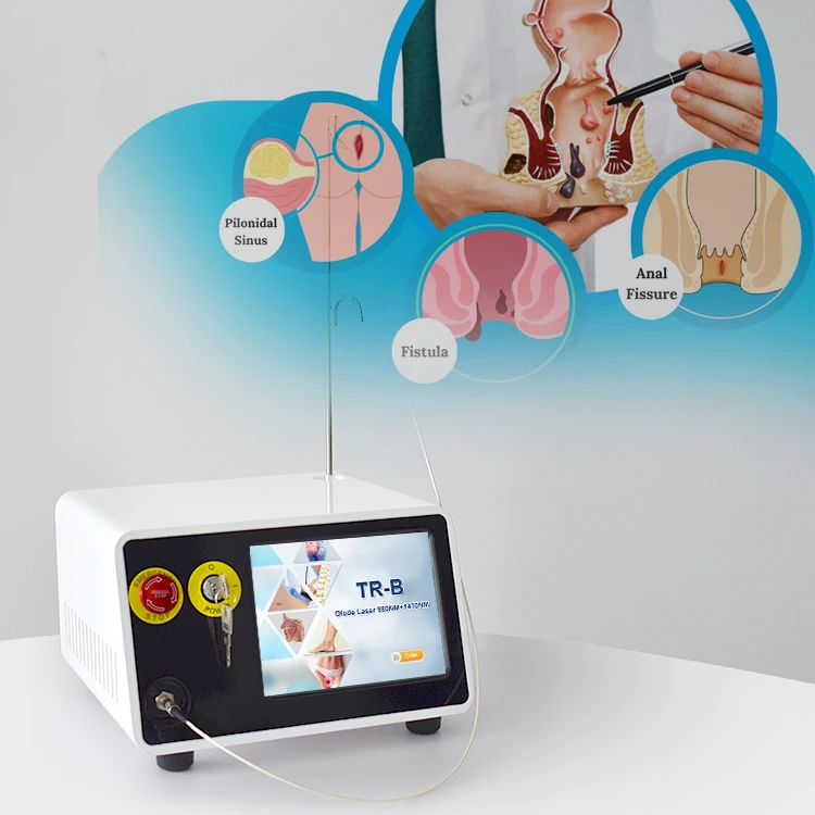 Dual wave 980nm 1470nm diode laser treatment hemorrhoid and hemorrhoid cutting