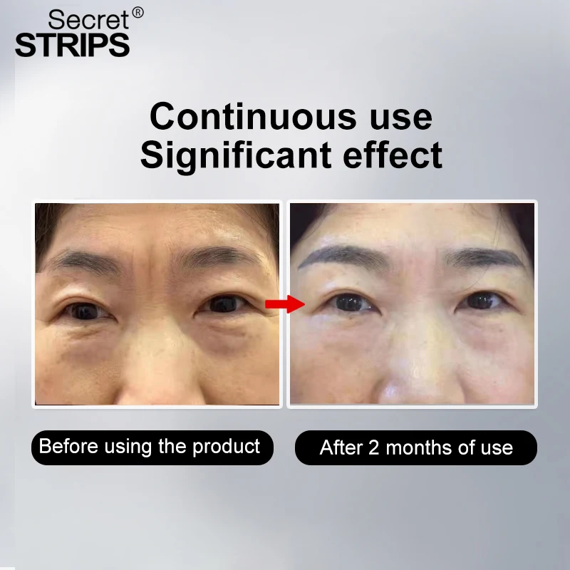 Cosmetic Face Facial Skin Masks Anti Wrinkle Frown Lines Wholesale Facial Mask Anti Frown lines Care Strips