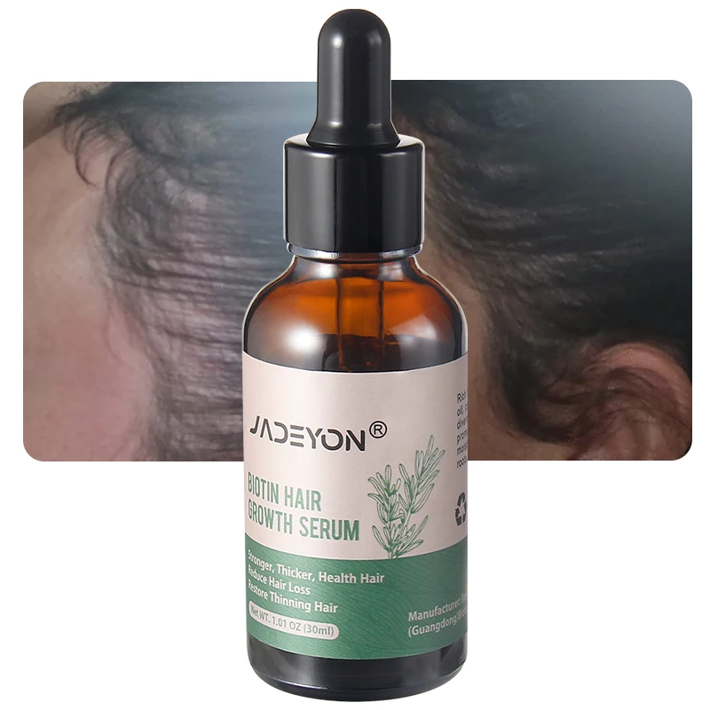 Private Label Wholesale Natural Organic Fast Grow Hair Regrowth Nourishing Treatments Serum Rosemary Essential Oil Hair Growth