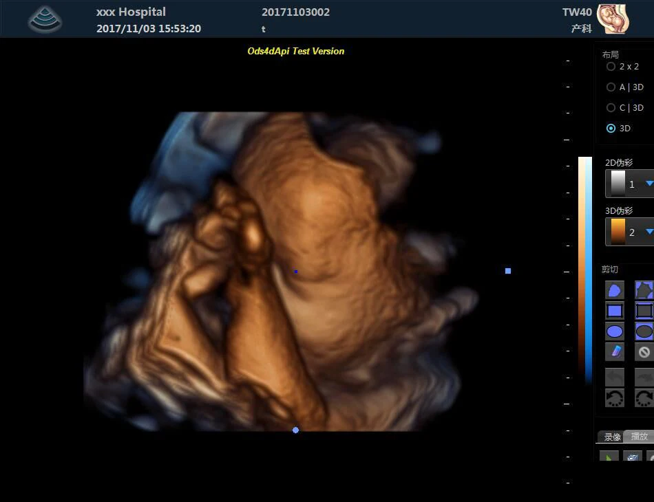 Medical ecografo portatil doppler cardiac 3d 4d ultrasound machine for gynecology